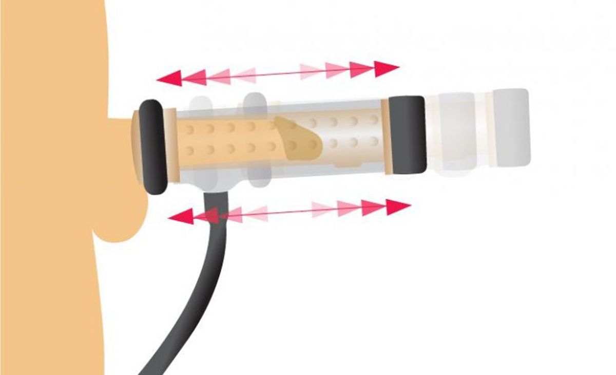 Textured Milker Cylinder